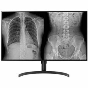 32in 8MP Diagnostic Monitor